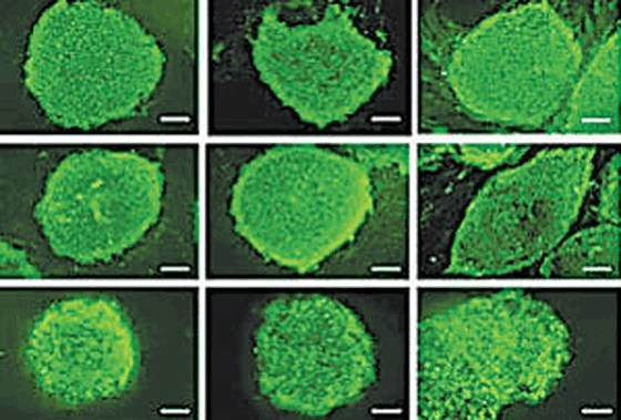 Quá trình phát triển của tế bào gốc từ mô sẹo quan sát dưới kính hiển vi